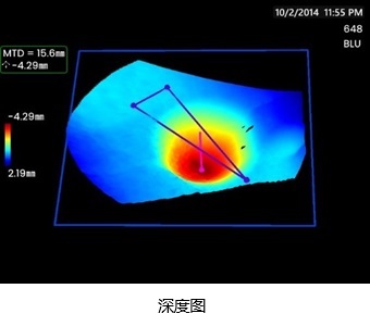3DPM-深度圖 3DPM-深度圖
